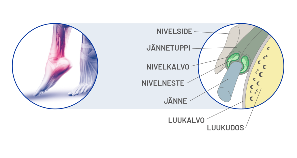 Lihakset Ja Nivelet Cetilar